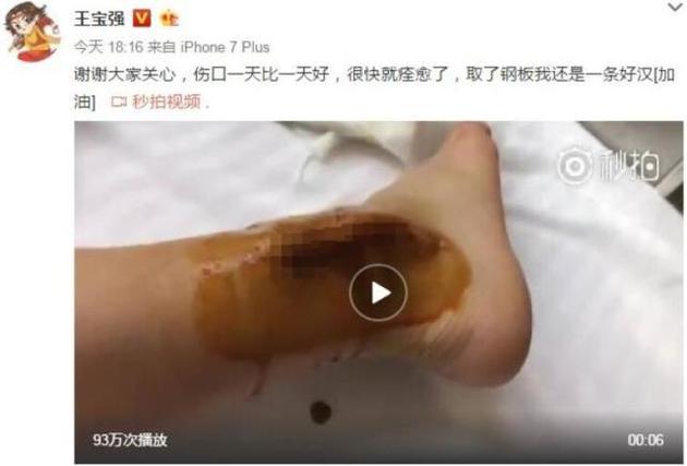 ������΢���؈D