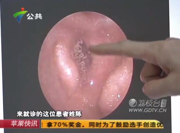 �@�֣����Ӷ���(n��i)�L(zh��ng)�M��ɫ���x��˺ҧ����ʹ��������