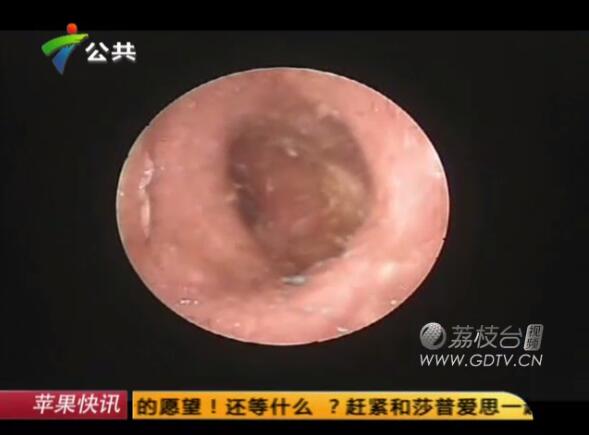 �@�������Ӷ���(n��i)�L(zh��ng)�M��ɫ���x��˺ҧ����ʹ��������