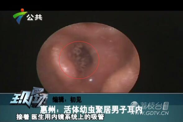 �@�������Ӷ���(n��i)�L(zh��ng)�M��ɫ���x��˺ҧ����ʹ��������