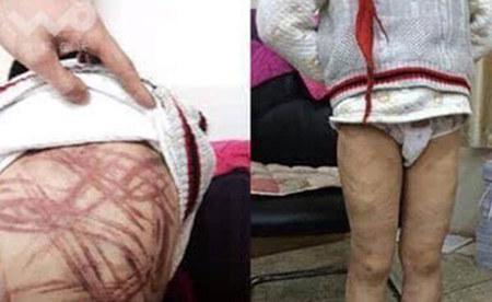 �����P(gu��n)ע�ġ��Ͼ�Űͯ������������11��20������9�r(sh��)���Ͼ�����Ժ�_ͥ�������������F(xi��n)�����(b��o)ӛ�߷քe�ĺ������B(y��ng)ĸ�����ٵĴ����Ɏ�̎�˽⵽��11��13�������������յ����Ͼ�����Ժ�_֪ͥͨ�������ٹ������һ�������Ͼ�����Ժ�������ͥ�����������幫�_������