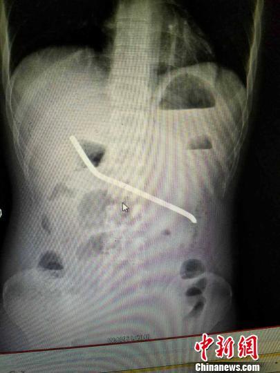 ����һ�����cŮ�Ѱ���ŭ��20�����L䓽�