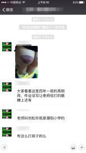 С�W(xu��)����δ������I(y��) ���w��̎���ώ����