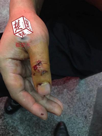 ������ҧ������ָ5��犲��� ����耳׎�����