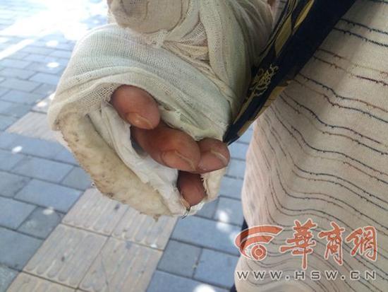 �Ύ�����5�³��ڵ��P�h��ӭ�e����ɻ�r�܂�����������ؓ؟���b·�ϵ�ˮ�������܇�����ӵ�����r������������ץ���������A�O�õ�λ����ţ���֪��ε�܇�͵ض���һ���������S֮һ�����Ύ������ִ�Ĵָ��СĴָͬ�r���A�ڃɸ��������g������������