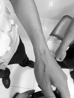 �񾯵��ֱ�ץ��