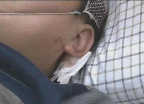 �����һ�𱻴�ģ�߀��������߅�����ϵ��ܴ������(j��ng)�^�t(y��)�������Д����ܴ�����~��Ƥ��ܛ�M�����[Û��һֱ���ڻ��Ԡ�B(t��i)��Ŀǰ߀�]�ж��^Σ�U����